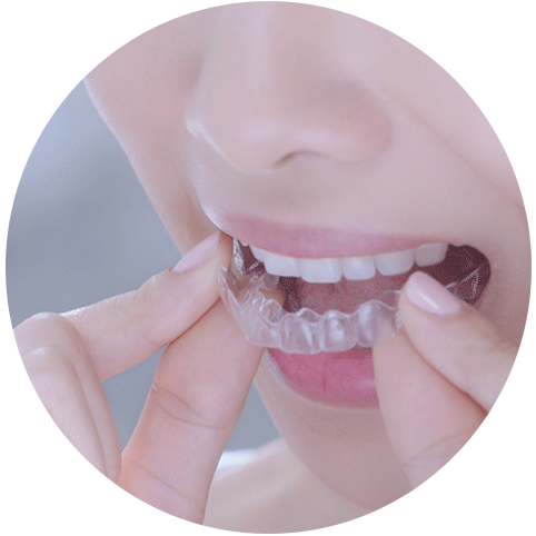 Invisible braces in south Delhi